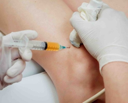 echogeleide injectie echogeleide injectie