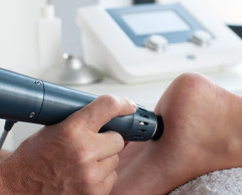 shockwave therapie shockwave therapie
