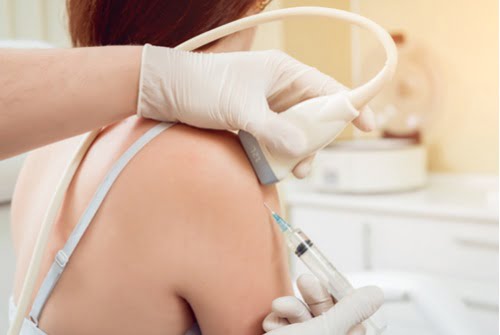 cortisone injectie echogeleid Echogeleide cortisone injectie in de schouder bij Orthozorg: orthopeed en echografist werken samen tijdens hetzelfde consult