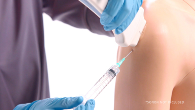 Echogeleide cortisone-injectie in de schouder bij slijmbeursontsteking